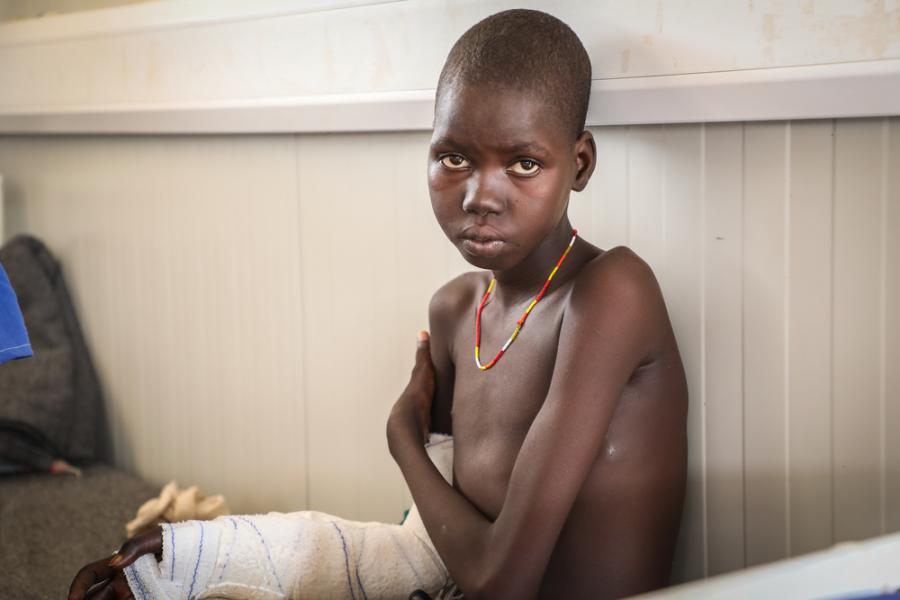 Awien Maguor, a snakebite patient in the post-op ward