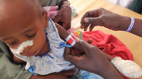 Chad- Nutrition programme in Massakory