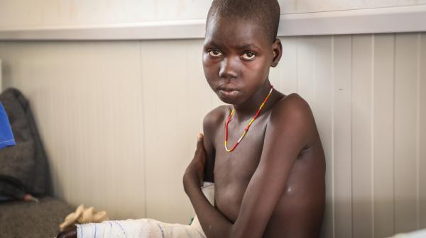 Awien Maguor, a snakebite patient in the post-op ward